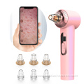 Vacuum Remove Skin Acne Point Nose Blackhead Device